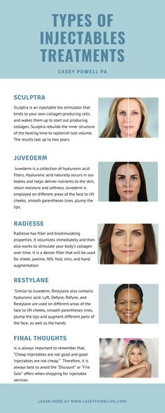 Types Of Fillers, Botox Reconstitution Chart, Check Filler Before And After, Dysport Injection Sites, Dysport Vs Botox Units, Botox Areas On Face, Face Contouring Fillers, Cosmetic Nurse Aesthetic, Facial Balancing Filler