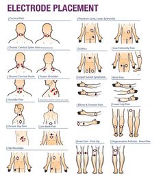 Tens Unit Placement Charts, Tens Electrode Placement, Knees Exercises, Tens Unit Placement, Body Points, Physical Therapy Student, Tens Machine, Tens Unit, Ten Unit