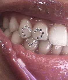 a close up of a person's mouth with teeth that have diamonds on them