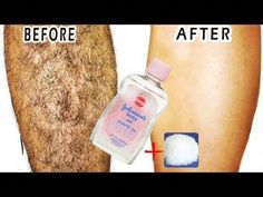 How To Permanently Remove Facial Hair, Healthy Website, Reverse Cavities, Hair Removal For Men