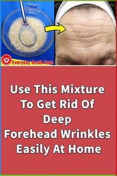 Are you looking for How To Get Rid Of Wrinkles On Forehead? We will share with you How To Get Rid Of Wrinkles On Forehead with a natural mixture. #getridofwrinkles #howtogetridofwrinklesonforehead #everydayhealthcare #howtogetridofwrinkles #howtoremovewrinkles #foreheadwrinkles #wrinklesonforehead #howtogetridofwrinklesforehead #getridofwrinklesonforehead #howtogetridofwrinklesforehead #howtogetridofwrinklesinforehead Wrinkles On Forehead, Deep Forehead Wrinkles, Clear Skin Fast, Get Rid Of Wrinkles, Heath Care, Clear Skin Tips, Acne Solutions, Spa Day At Home