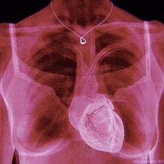 an x - ray image shows the chest and lungs in red light, with a heart hanging from it