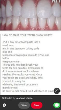 Whiten Teeth At Home, Natural Teeth Whitening Remedies, Teeth Whitening Methods, Teeth Whitening Homemade, Teeth Whitening Remedies, Teeth Whitening Diy, Cleaning Advice, Whiten Teeth, Tooth Sensitivity