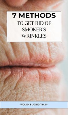 If you're a smoker or a former smoker, you probably have wrinkles around your mouth. Find out how to get rid of smoker's lines. Lines Around Mouth, Smokers Lines, Mouth Wrinkles, Wrinkle Remedies, Wrinkle Filler, Lip Wrinkles, Forehead Wrinkles, Face Exercises