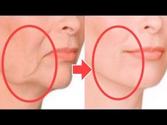 Anti-Aging Face Lifting Massage For Sagging Jowls, Cheeks! Look 20 Years Younger, Tighten The Skin - YouTube Face Lifting Massage, Sagging Jowls, Wrinkles Remedies Face, Sagging Cheeks