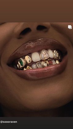 a woman's mouth with gold teeth and rings on it, in front of the camera