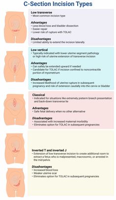 the different types of stomachs and their functions