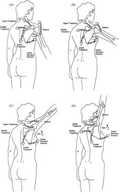 the diagram shows how to use an arm sling for shoulder and back pain, as well as