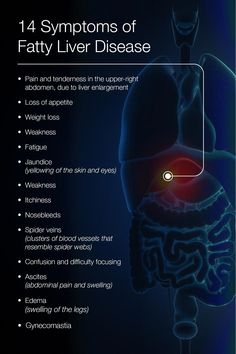 Little evidence supports the apple cider vinegar fatty liver detox, unlike other natural treatment approaches such as the use of amino acid supplements. Quadrants Of The Abdomen, Sinus Congestion Relief, Amino Acid Supplements, Liver Diet