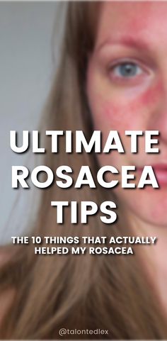 After 17 years of rosacea, these are the top 10 things that actually helped. Rosacea advice, rosacea treatment, rosacea tips. How To Treat Redness On Face, Skincare Products For Redness, Benefits Of Rosehip Oil For Face, Rose Rosette Disease, Different Types Of Acne, Roscea Help, Sensitive Skincare, Pimples Remedies, Get Rid Of Acne