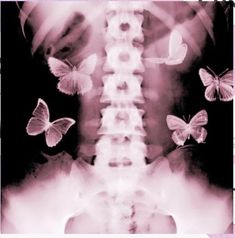 an x - ray image with butterflies flying around it