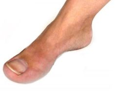 a close up of a person's bare foot