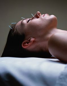 Acupuncture Benefits, Facial Rejuvenation, Acupuncture Points, Alternative Therapies, Hip Pain, Traditional Chinese Medicine, Chinese Medicine, Acupressure, Alternative Medicine