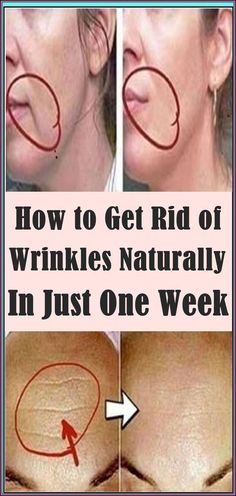 How To Get Rid Of Wrinkles Natural by sharon Thomas | This newsletter was created with Smore, an online tool for creating beautiful newsletters for educators, businesses and more Get Rid Of Wrinkles, School Communication, Unwanted Hair Removal, Dry Lips, Health Facts, Happy People, One Week