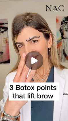 Dr. Bita Farrell on Instagram: "#botoxbrowlift #browlift #drbitafarrell #naturalaestheticscenter" Brow Lift Botox Eyebrows, Eyebrow Lift, Botox Cosmetic, Thread Lift, Facial Fillers