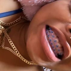 Gold Braces With Color Bands, Dark Skin With Braces, Braces Aesthetic Girl, Braces With Rubber Bands, Braces Black Women, Brace Ideas, Braces Colours, Power Chain Braces