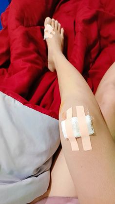 a woman laying on top of a bed next to a red blanket with bandages around her legs