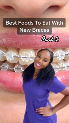 Silver Braces Color, Navy Blue Braces Teeth, Clear Braces With Color Bands, Best Color For Braces, Best Braces Colors Ideas, Good Braces Colors, Star Braces, Pretty Braces Colors, Braces Colors Aesthetic