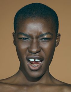 a young man with his mouth open showing teeth