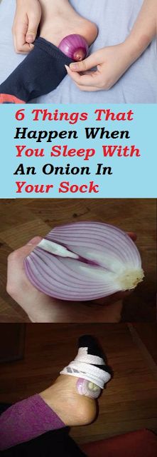 6 Things That Happen When You Sleep With An Onion In Your Sock - BEAUTIFUL DIY AND HEALTH Onion In Your Sock, Flourless Recipes, Body And Health, Natural Recipes, Cleanse Diet, Exercise Inspiration, Cabbages, When You Sleep, Air Purifiers