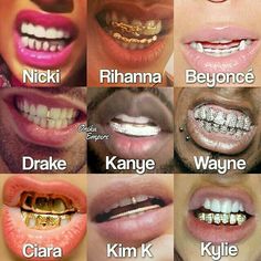 Braces Grillz, Grillz Teeth Men, Tooth Grill, Girls With Grills, Girl Grillz, Teeth Grills, Cute Braces Colors, Pretty Teeth, Grillz Teeth