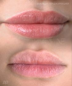 Lip Blush, Lip Filler, Baby Lips, Lip Tattoos, Lip Injections, Lip Fillers, Permanent Makeup