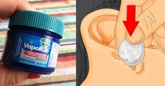 Vic Vaporub, Ear Congestion, Cough Suppressant, Vicks Vaporub