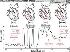 the diagram shows different stages of an animal's heart