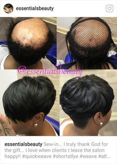 Alopecia hair styles Quick Weave On Bald Head, Short Sew In Hairstyles, Hairstyling Tips, Quick Weaves, Short Weave Hairstyles, Black Women Short Hairstyles, Short Weave