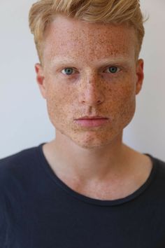 a man with freckles on his face looking at the camera while wearing a black t - shirt