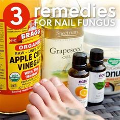 Natural Nail Treatment. There are any references about Natural Nail Treatment in here. you can look below. I hope this article about Natural Nail Treatment can be useful for you. Please remember that this article is for reference purposes only. #natural #nail #treatment Nail Remedies, Emerald Nails, Nail Fungus Remedy, Nail Infection, Fungal Nail, Toenail Fungus, Nail Fungus, Cider Vinegar, Green Nails