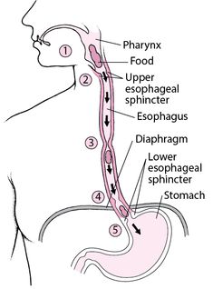 Throat and Esophagus - Digestive Disorders - MSD Manual Consumer Version Esophageal Varices, Chronic Lung Disease, Human Digestive System, Lung Infection, Speech Language Therapy, Medical Education, Anatomy And Physiology, School Of Medicine, Digestive System