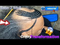 Any Alopecia style can be achieved JUST WATCH THIS😱😱😱 - YouTube Alopecia Cover Up Braids, Alopecia Hairstyles Black Women Braids, Braids For Women With Alopecia, Braid Styles For Thinning Edges, Braids To Cover Bald Edges, Braids That Cover Bald Edges, Braids For Alopecia For Black Women, Braids With Alopecia, Braids For Alopecia