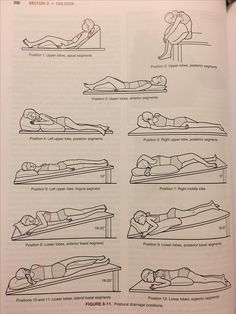 Postural drainage positions Postural Drainage, Pt Student, Posture Correction Brace, Nurse Skills, Belly Pooch Workout, Physical Therapy Student, Sleep Posture, Physical Therapy Assistant, Med Surg Nursing