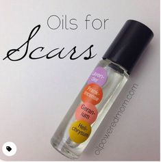 Oils For Scars, Homemade Lotion, Essential Oil Roller, Young Living Oils, Doterra Oils, Oil Uses, Fractionated Coconut Oil, Essential Oil Uses, Natural Beauty Tips