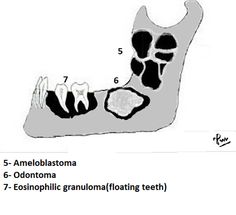 Surgery Art, Pediatric Radiology, Maxillofacial Surgery, Registered Dental Hygienist, Oral Pathology, Interventional Radiology, Dental Anatomy, Dental Fun