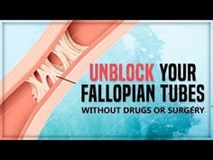 How To Unblock Fallopian Tubes, Unblock Fallopian Tubes Naturally, Blocked Fallopian Tubes Natural Remedies, Fallopian Tube Blockage Natural Remedies, Unblock Fallopian Tubes, Fertility Cleanse, Fallopian Tube Blockage, Healing Tea Recipes, Omg Newjeans