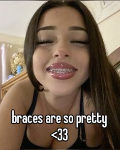 #braces #fyp #whisper Cute Braces Colors For Brown Skin, Braces Before And After Glow Up, Sage Green Braces, Braces Navy Blue, Orange Braces, Dark Blue Braces, Pretty Braces, Before And After Braces, Braces Aesthetic