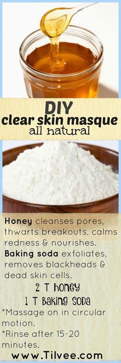 Face Mask For Pores, Diy Acne, Home Remedies For Acne, Plant Based Skincare, Homemade Diy, Beauty Remedies, Homemade Face Masks