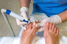 Nail Foot Hospital. There are any references about Nail Foot Hospital in here. you can look below. I hope this article about Nail Foot Hospital can be useful for you. Please remember that this article is for reference purposes only. #nail #foot #hospital Broken Toenail, Curved Toenails, Nail Foot, Bad Nails, Nail Problems, Ingrown Nail, How To Cut Nails, Popular Nail Designs