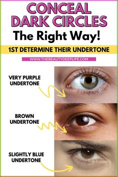 In order to pick the best concealer for your dark circles and make sure your are using the RIGHT one, you first need to determine what undertone is visible under your eyes. Learn more about this tip from a makeup artist on the blog! Then ensure you hide your dark circles the right way and check out our round-up of top 10 expert-approved concealers! Dark Under Eye Color Corrector, Tips For Under Eye Dark Circles, What Color Corrector For Dark Circles, Best For Dark Circles Under Eyes, Best Dark Circle Concealer, Concealer For Deep Set Eyes, Color Corrector For Dark Circles Under Eyes, Concelear Application Dark Circles, Dark Circles Under The Eyes Makeup