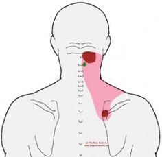 Punkty Spustowe, Trigger Point Therapy, Stiff Neck, Trigger Points, Body Pain, Shoulder Pain