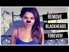 SUBSCRIBE → http://bit.ly/1r9sVmnINSTAGRAM → http://instagram.com/nishunleashedTWITTER → http://twitter.com/nishunleashedFACEBOOK → http://facebook.com/nishu... How To Remove Blackheads, Blackhead Remedies, To Remove Blackheads, Blackheads On Nose, Prevent Pimples, Mole Removal, Acne Face Wash, Remove Blackheads