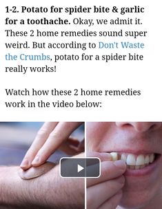 Spider Bites, Home Remedies