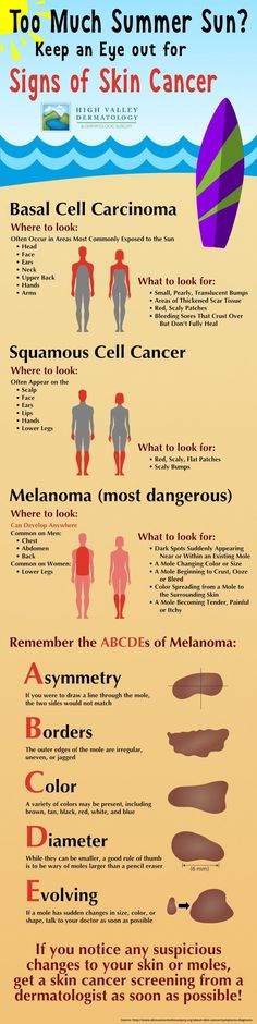 Squamous Cell, Glow Skin, Skin Disorders, Scar Tissue, Health Info, Health Goals, Dermatology, Skin Treatments, Different Types