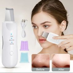 Ultrasonic Skin Scrubber, Face Deep Cleaning Machine, Peeling Shovel, Facial Pore Cleaner, Skin Scrubber, Skin Lifting Beauty Instrument Electric Facial Cleanser, Clean Skin Face, Skin Spatula, Ultrasonic Skin Scrubber, Cleaner Face, Facial Scrubber, Deep Cleansing Facial, Face Pores, Lifting Facial