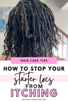 Starter Locs Journey, How To Reduce Dandruff, Styling Locs, Loc Care, Loc Maintenance, Scalp Cleanse, Locs Journey, Scalp Itch