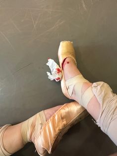 a woman's legs with bandages and shoes on