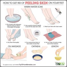 Diy Pedicure, Combination Skin Type, Pedicure At Home, Foot Scrub, Peeling Skin, Skin Care Steps, Oily Skin Care, Dry Skin Care