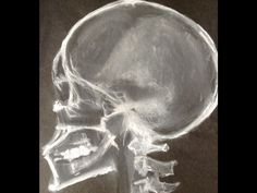 an x - ray image of a human skull showing the lower part of the head